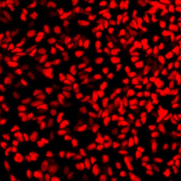 Immunofluorescence image of human induced neural crest cells labeled with DSHB antibody PCRP-SOX10-1D8 against sox10. Image Credit: Lucas Alvizi. PMID: 37225711, Fig. S8.